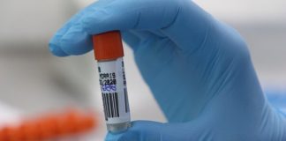 Covid-19: Santa Catarina investiga 12 casos suspeitos de reinfecção pelo vírus