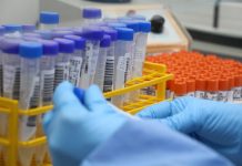 Covid-19: Joinville registra 11 óbitos e 130 novos casos neste domingo