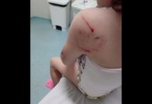 Pai registra boletim na polícia após filhas serem atacadas por cachorros no Planalto Norte