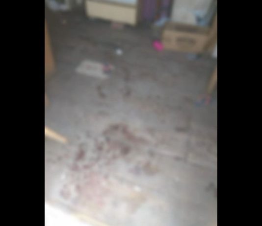 Homem é preso suspeito de tentar matar companheira com golpes de foice em Joinville